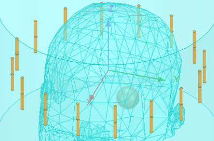 Monitoring of Brain with Microwave Imaging - MM Dimension Diagram